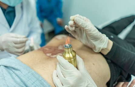 科技名词|火针疗法 fire needle therapy；puncturing point with hot-red needle
